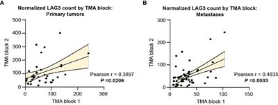 Location matters: LAG3 levels are lower in renal cell carcinoma metastatic sites compared to primary tumors, and expression at metastatic sites only may have prognostic importance